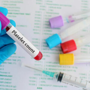 Low platelets count – Its causes and symptoms