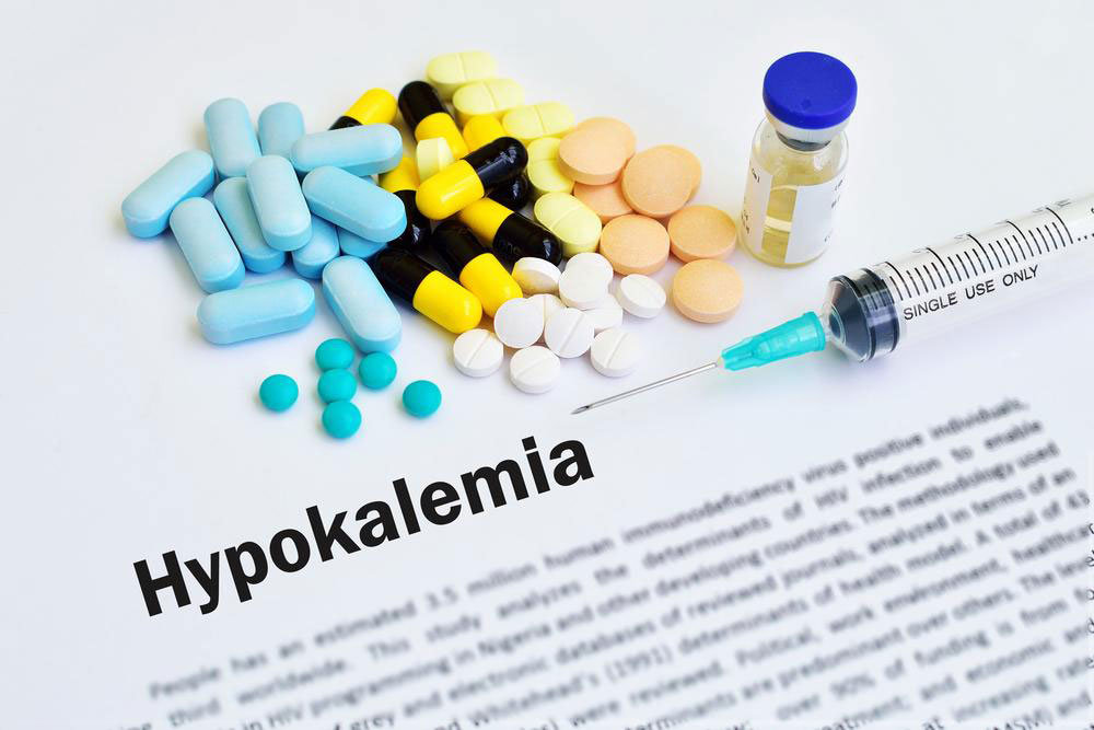 Hypokalemia – what you should know